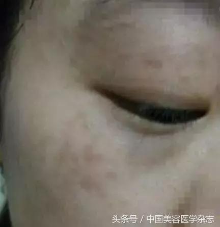 脸部变化会观察,言语重点善摸抓是什么生肖，全面释义、科学解答解释落实